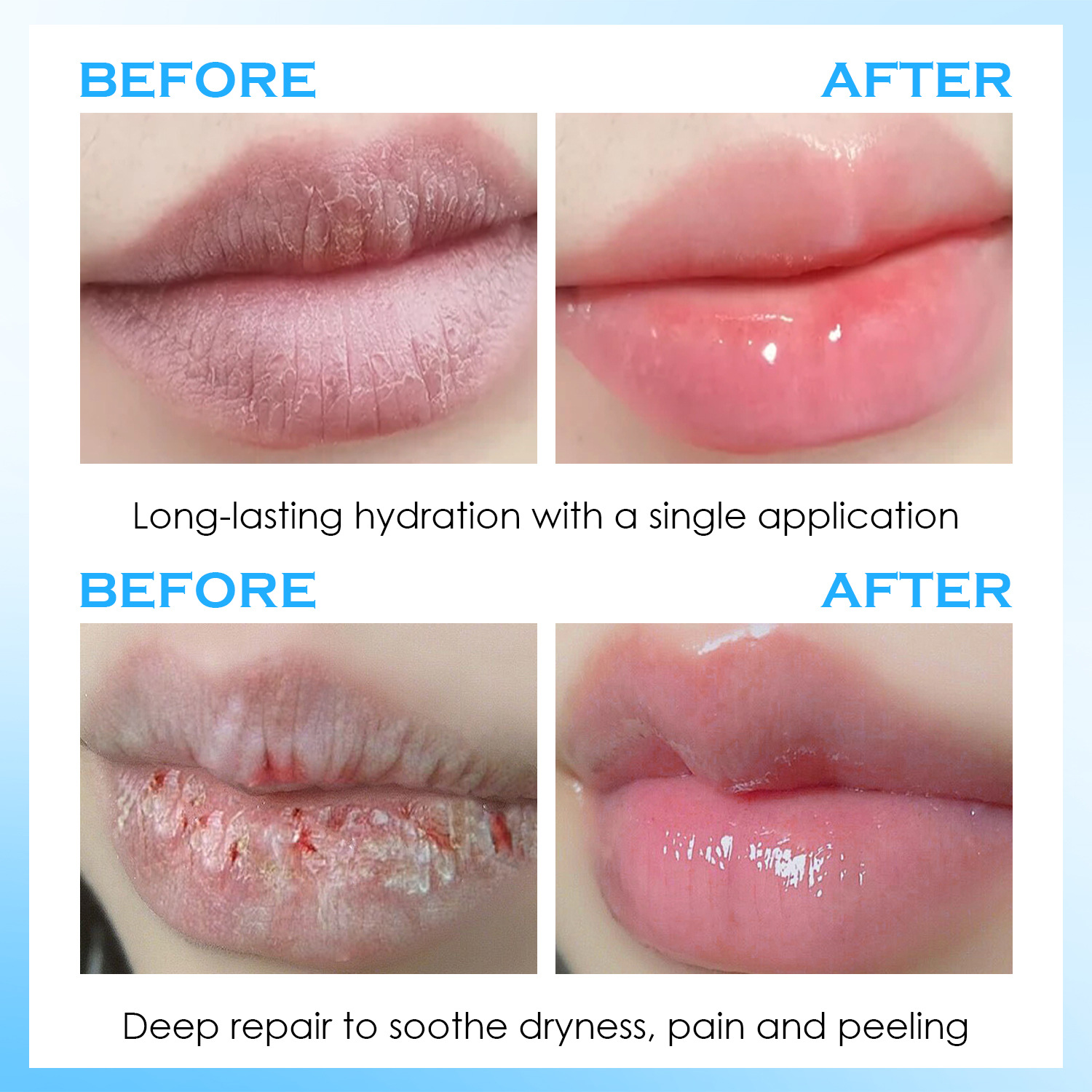 Сыворотка для губ, увлажняющий – обзор и цена Lip Balm